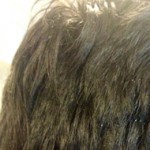 Does Our Hair Turn Into White For Dandruff?