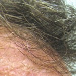7 Things You Don’t Know About The Graying Of Hair